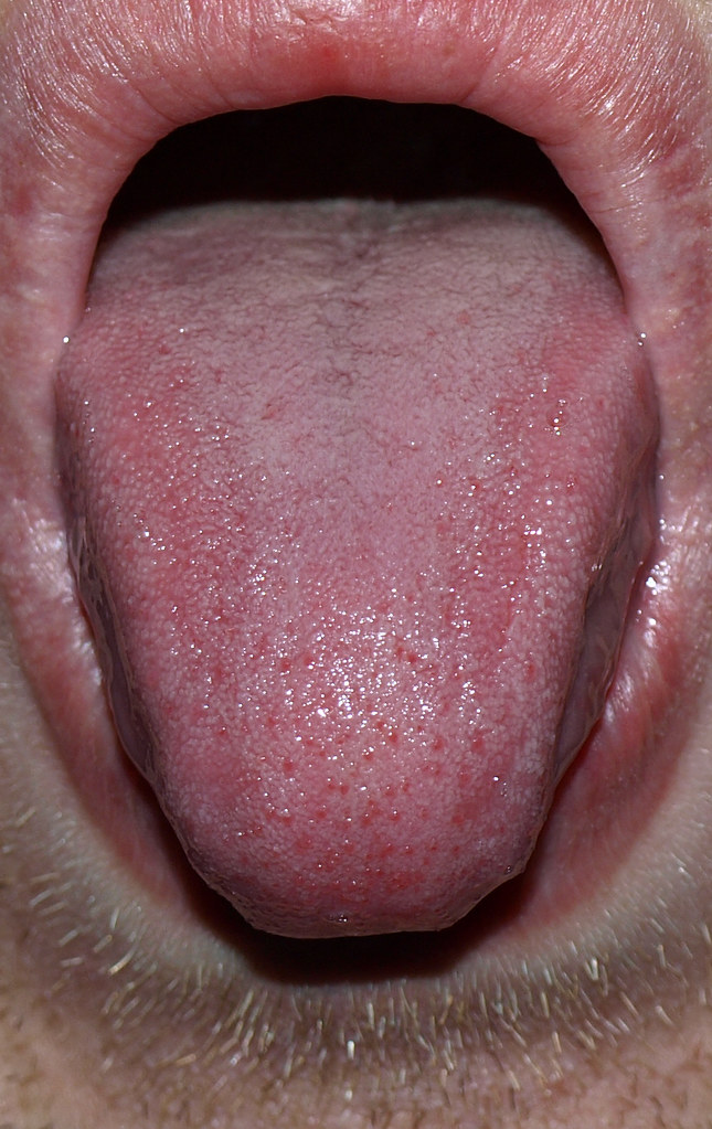 చేతి న‌రాల‌తో నాలుక.. డాక్టర్ల సృష్టి మాములుగా లేదుగా…?