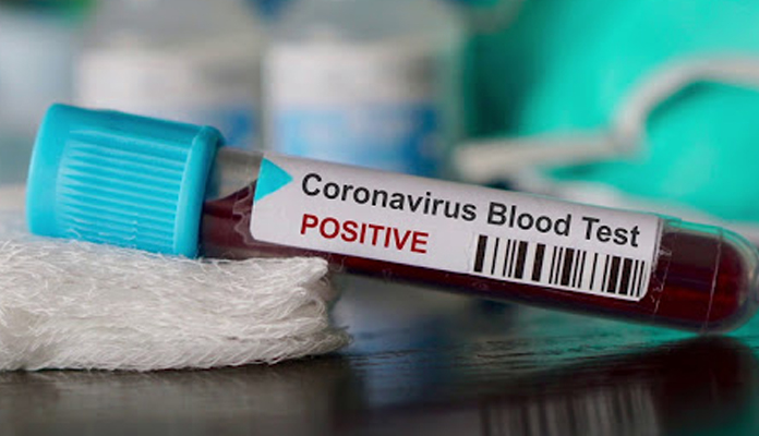 ఏపీలో నమోదైన తొలి కరోనా కేసు.. ఆందోళనలో నెల్లూరు వాసులు