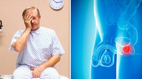 ప్రోస్టేట్ గ్రంథి  ఉత్ప‌త్తి లేక‌పోతే పురుషుల సంగ‌తి ఇక అంతే?