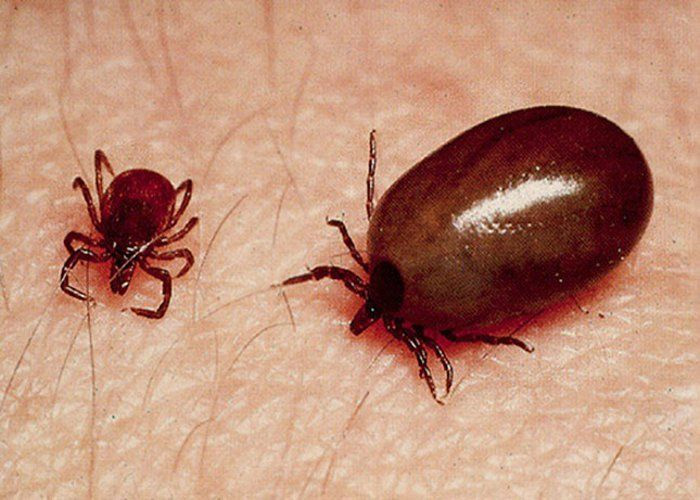 scrub typhus virus tension in vishakapatnam