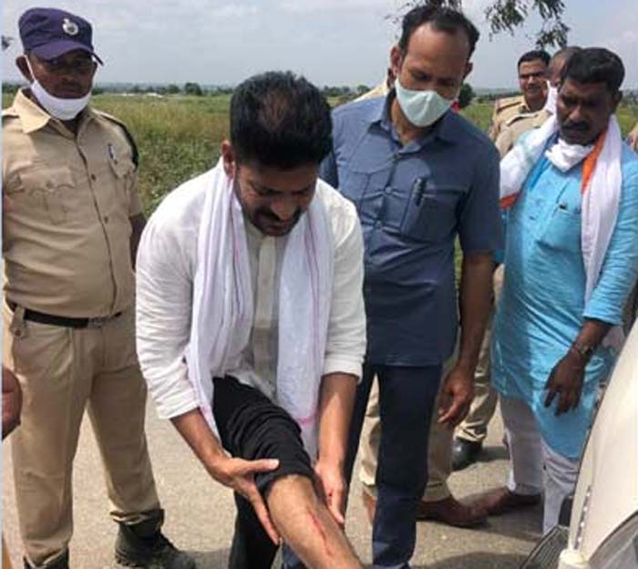 revanth reddy arrested while going to visit kalwakurthy project