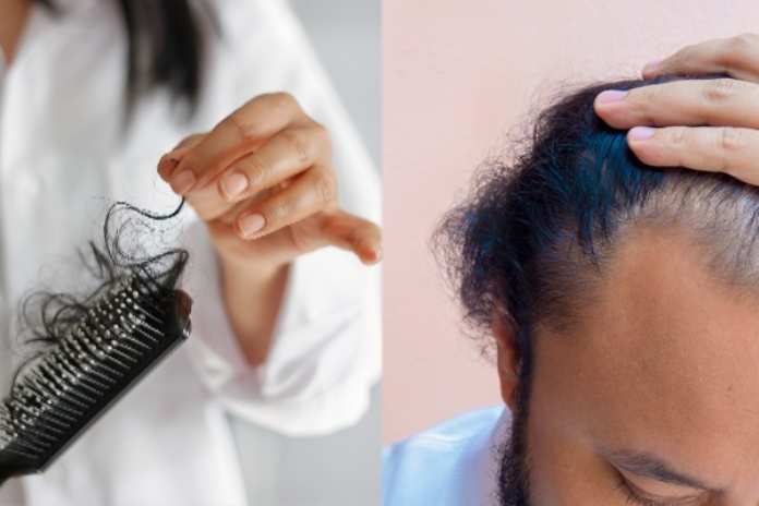 జుట్టు రాలిపోతోందా..? బట్టతల సూచనలా..? ఈ ఫుడ్ తప్పనిసరి..!!