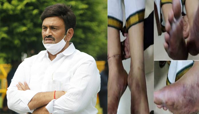 ఆర్ఆర్ఆర్: రఘురామకృష్ణరాజు స్వయంకృతాపరాధం.!