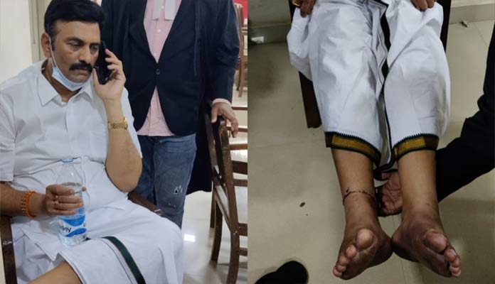 రఘురామకి అదే భయం.. వరుస అరెస్టులు తప్పేలా లేవే.!