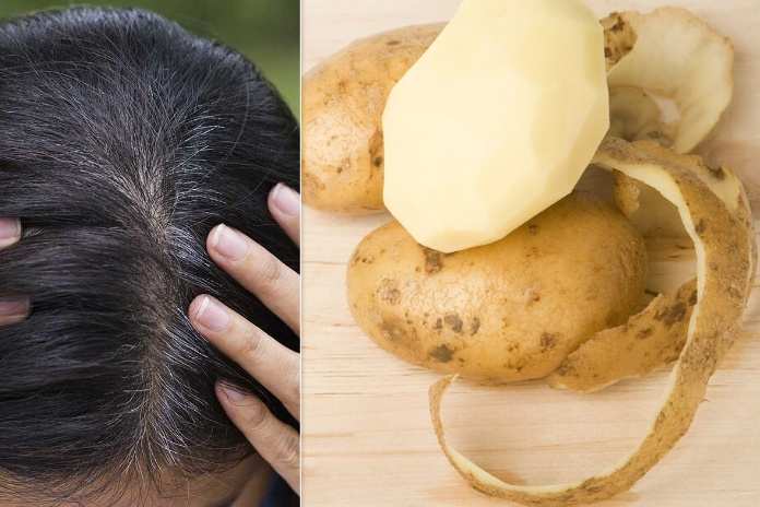 Hair: జుట్టు తెల్లబడిందా..! బంగాళాదుంపలతో ఏం చేయాలంటే..