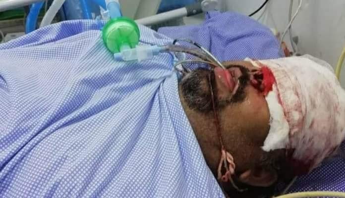 రోడ్డు ప్రమాదంలో కత్తి మహేష్‌కు తీవ్ర గాయాలు.. చెన్నై తరలింపు