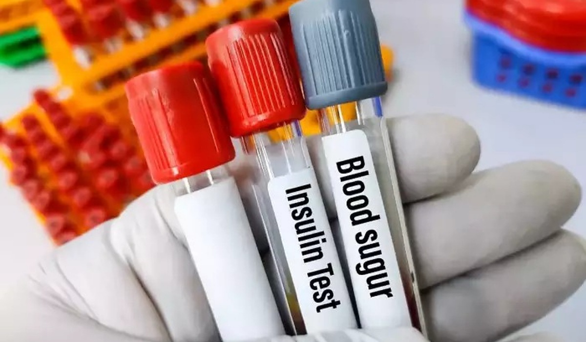 మీకు ఈ సమస్య వచ్చిందంటే.. జీవితంలో వదలని రోగం వచ్చినట్టే!