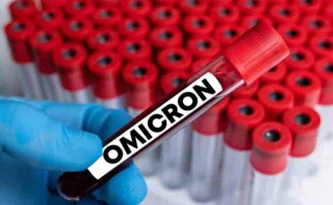Omicron : ఒమిక్రాన్.. లైట్ తీసుకోవద్దంటున్న సినీ సెలబ్రిటీలు.!