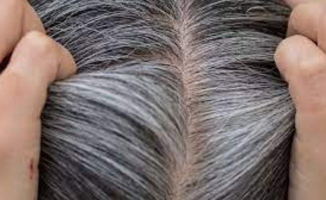 white Hair: తెల్ల జుట్టు సమస్యలతో బాధపడుతున్నారా.. ఈ చిట్కాలతో తెల్లజుట్టుకు చెక్ పెట్టండి!