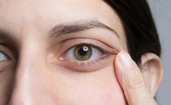 Puffy Eyes: ఉదయం నిద్ర లేచేసరికి మీ కళ్ళు ఉబ్బుతున్నాయా…అయితే ఈ చిట్కాలు పాటిస్తే సరి..!