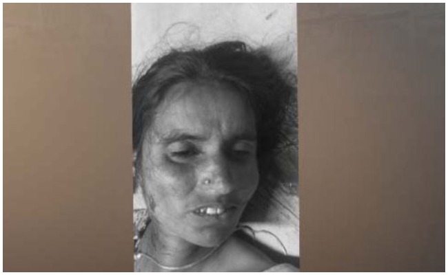 Crime News: అడవి పందుల దాడిలో అక్కడికక్కడే ప్రాణాలు కోల్పోయిన మహిళా రైతు..!