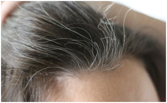 White Hair: తెల్ల జుట్టుతో ఇబ్బంది పడుతున్నారా? ఐతే ఒక్కసారి ఈ ఆయిల్ ట్రై చేయండి..!