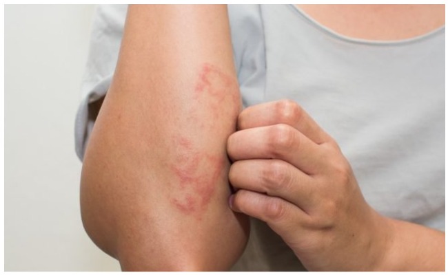 Blood Cancer:బ్లడ్ క్యాన్సర్ వచ్చినప్పుడు కనిపించే లక్షణాలు ఏవి? దానిని ఎలా గుర్తించాలి?