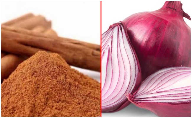 Dandruff: ఉల్లి తొక్కల షాంపూతో చుండ్రు సమస్యకు చెక్..!