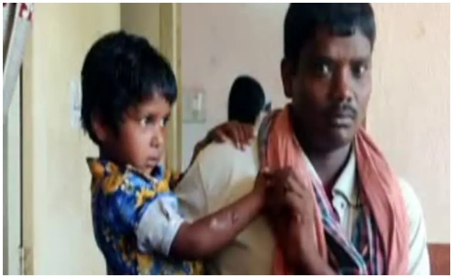 Crime News: మహబూబాబాద్‌ జిల్లాలో దారుణం.. చిన్నారి చేతిపై వాతలు పెట్టిన అంగన్వాడీ కార్యకర్త..!