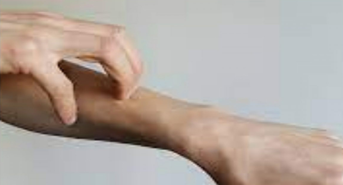 రాత్రిపూట బాగా దురదలు పెడుతున్నాయా… ఈ సమస్య ఉన్నట్టే?