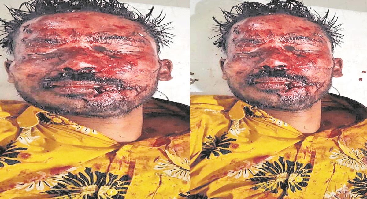 పెళ్లి చూపులకు వెళుతుండగా ప్రమాదం…రైలు నుండి జారిపడి మృతిచెందిన వ్యక్తి?