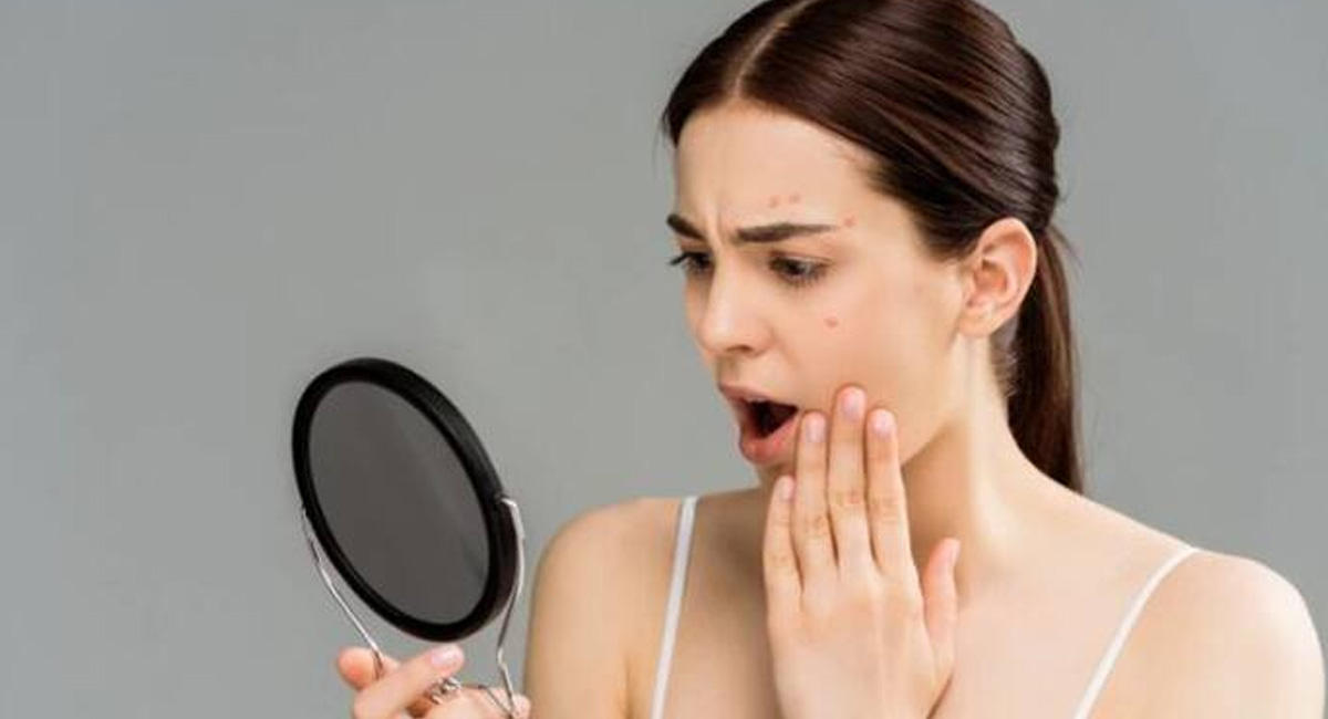 ముఖంపై జిడ్డు,మచ్చలు లేకుండా మెరవాలా.. అయితే ఈ చిన్న పని తోనే సాధ్యం!