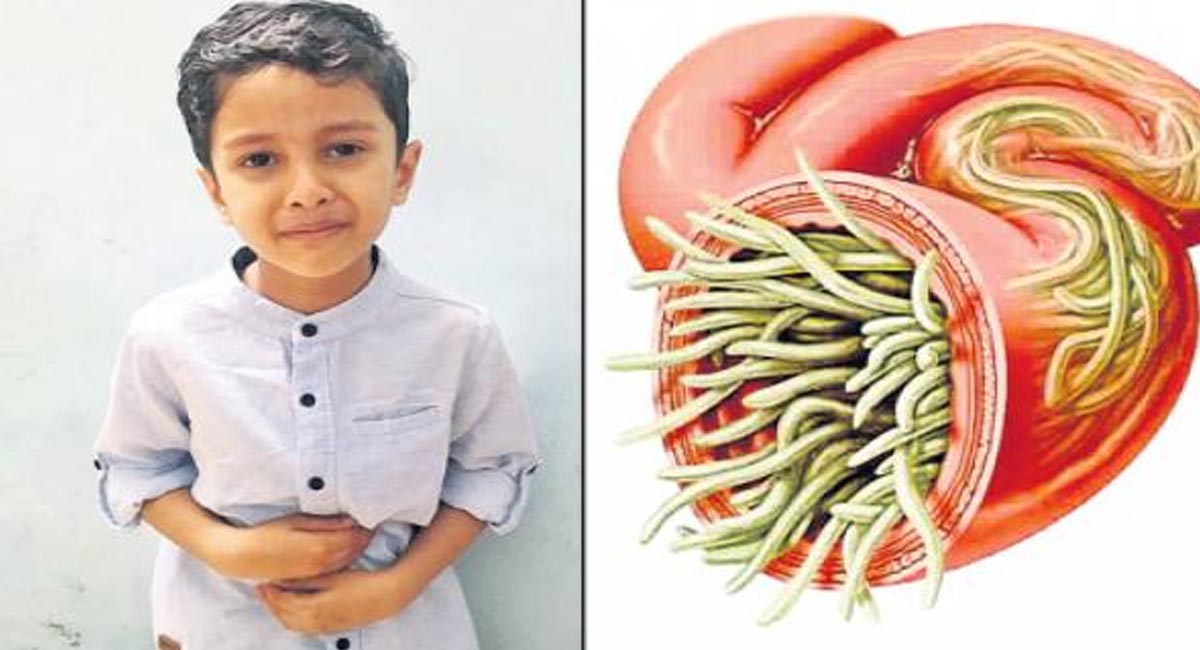 పిల్లల పెరుగుదల పై తీవ్ర ప్రభావం చూపే నులిపురుగు నివారణ మార్గాలు?