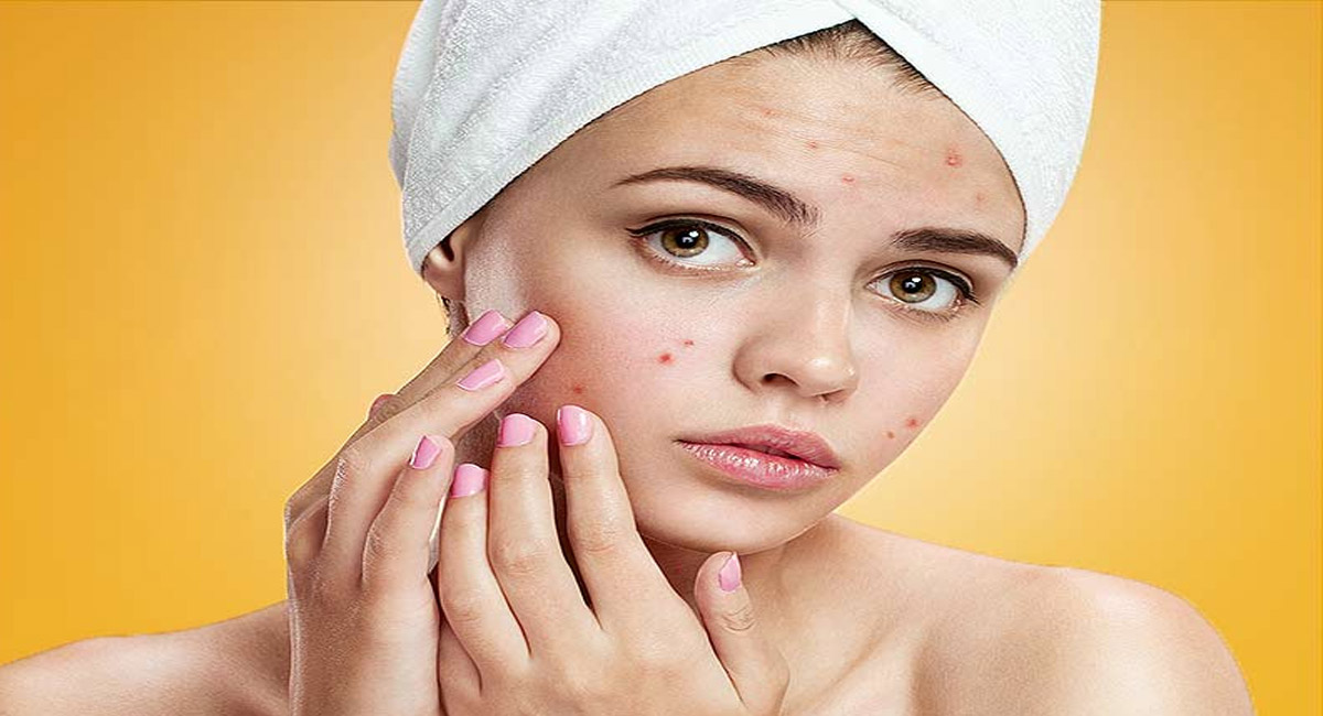 ముఖం పై నల్లని మచ్చలతో ఇబ్బంది పడుతున్నారా ఈ సింపుల్ చిట్కాలతో సమస్యకు చెక్ పెట్టండి!