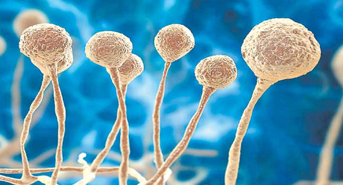 శ్వాసకోశ వ్యాధి, క్యాన్సర్ వంటి వ్యాధిగ్రస్తులకు పొంచి ఉన్న కొత్తరకం ఫంగస్ ముప్పు?