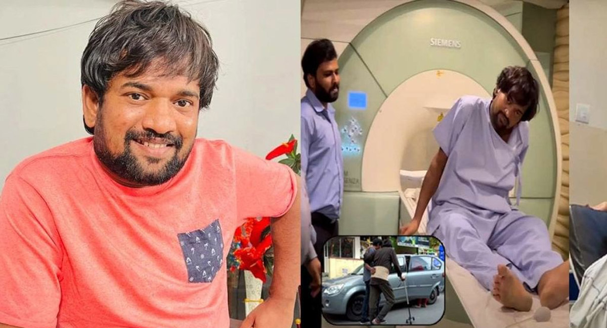 పంచ్ ప్రసాద్ ఆరోగ్యం పై స్పందించిన డాక్టర్స్.. ఏమన్నారంటే?