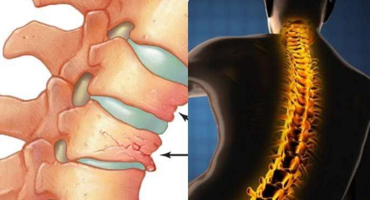 ఈ లక్షణాలు మీలో ఉంటే కాల్షియం లోపం తలెత్తినట్లే… కాల్షియం లోపిస్తే ఈ అనర్థాలు తప్పవు!