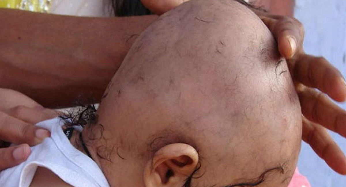 ఏడాదిలోగా పిల్లలకు పుట్టు వెంట్రుకలు తీస్తారు.. అలా తీయడానికి కారణం ఏంటో తెలుసా?