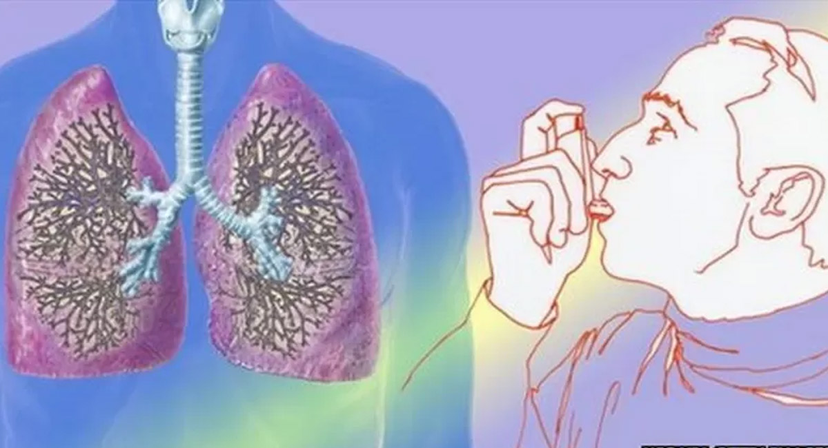 ఆస్తమా వ్యాధిగ్రస్తులు శీతాకాలంలో తీసుకోవాల్సిన అతి ముఖ్యమైన జాగ్రత్తలు ఇవే!