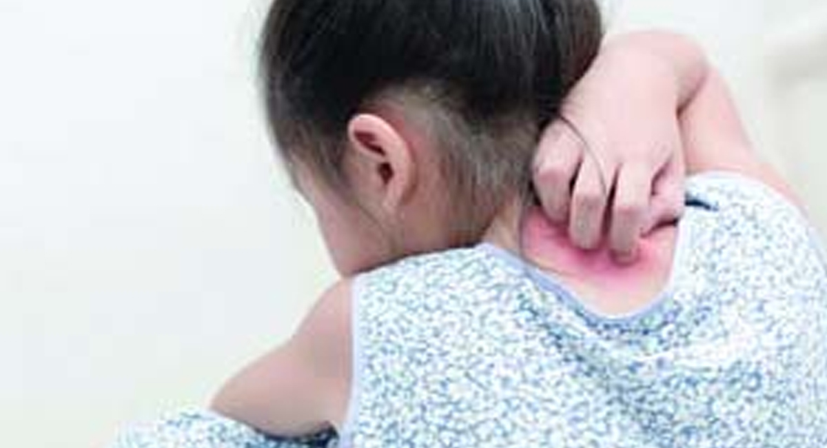 మీ పిల్లలు  తరచూ చర్మ సమస్యలతో బాధపడుతున్నారా?  ఇవే కారణాలు కావచ్చు!