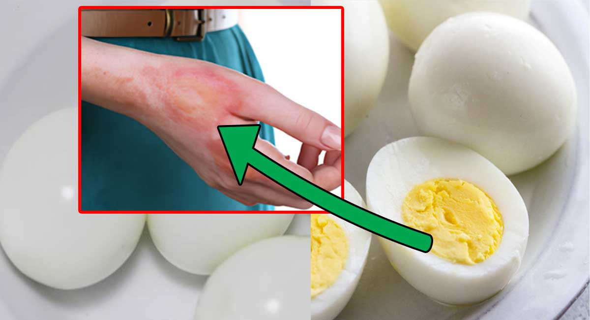 కోడిగుడ్డు తిన్న తర్వాత మీరు ఈ పదార్థాలు తింటున్నారా… మీరు ప్రమాదంలో పడినట్టే!