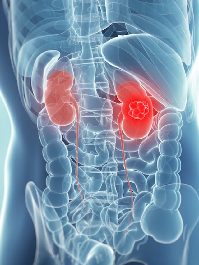 కిడ్నీ ఇన్ఫెక్షన్, డయాబెటిస్ ను తరిమికొట్టే అద్భుత ఔషధమే ఈ బోడ కాకర!