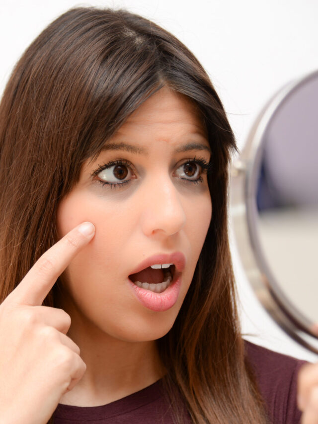 సహజ పద్ధతిలో కళ్ళ చుట్టూ ఏర్పడే నల్లని వలయాలను తగ్గించుకోవడం ఎలాగో తెలుసా?