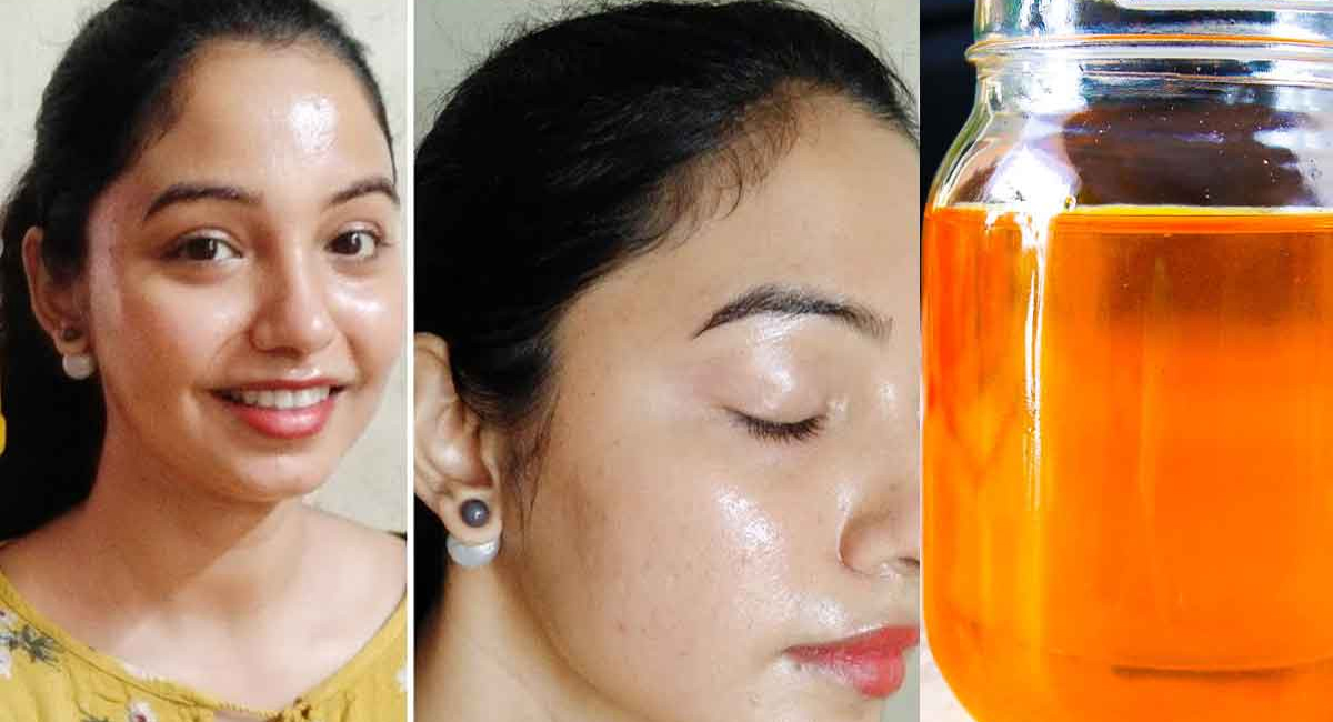 జిడ్డు చర్మంతో బాధపడుతున్నారా… రెండు చుక్కల ఈ ఆయిల్ తో జిడ్డు చర్మానికి చెక్ పెట్టండి!