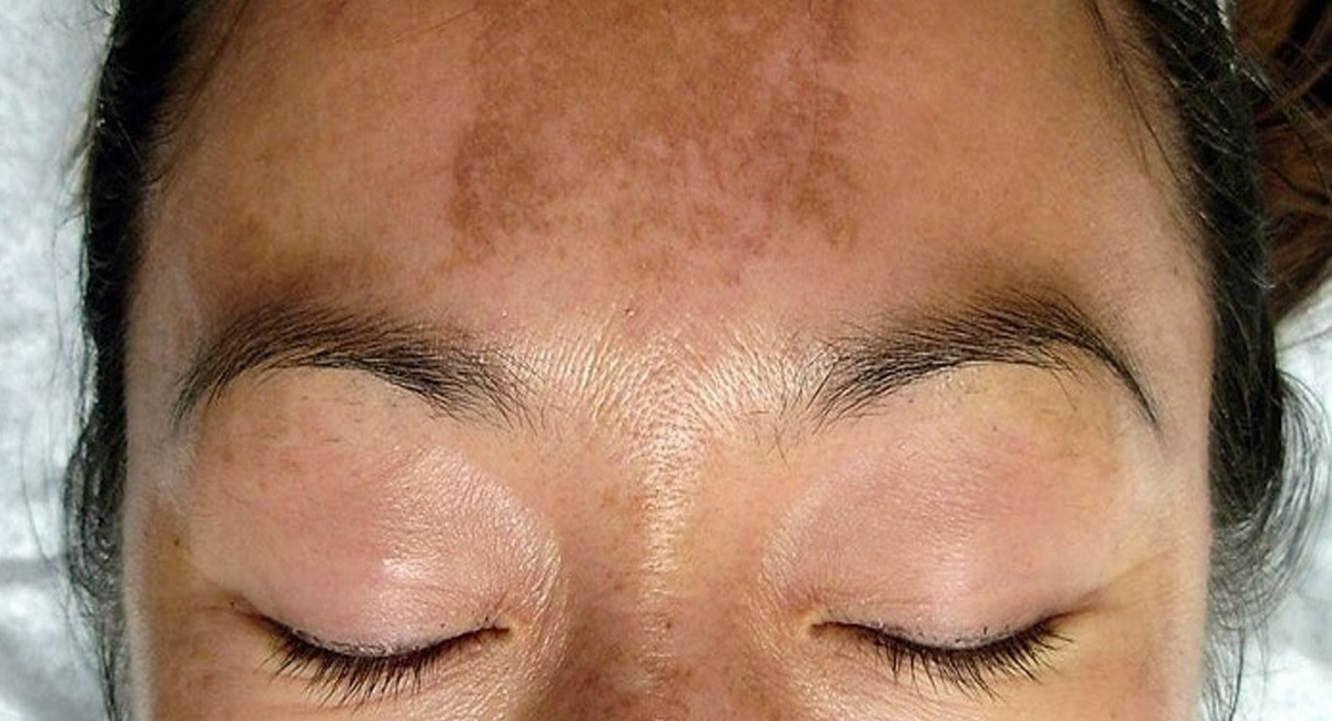 ముఖం నల్లగా మారిపోతుందా.. ఈ చిట్కాలు పాటించకపోతే ప్రమాదమంటూ?