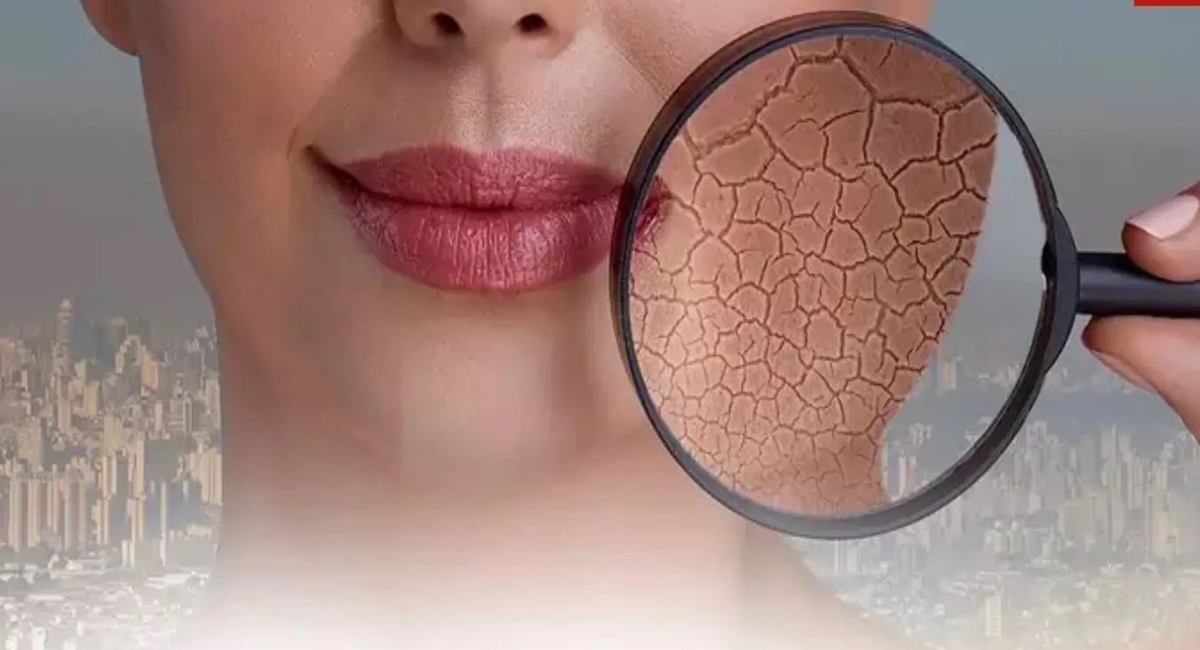 వాతావరణ కాలుష్యంతో చర్మ సమస్యలు ఎదుర్కొంటున్నారా.. ఈ మార్గాలతో సమస్యకు చెక్ పెట్టండి!