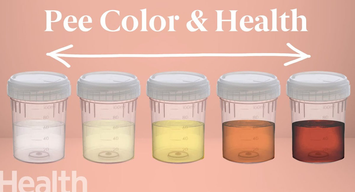 మీ మూత్రం రంగు ఆరోగ్య సమస్యలను సూచిస్తుందా.. ఈ తప్పులు మాత్రం చేయొద్దంటూ?