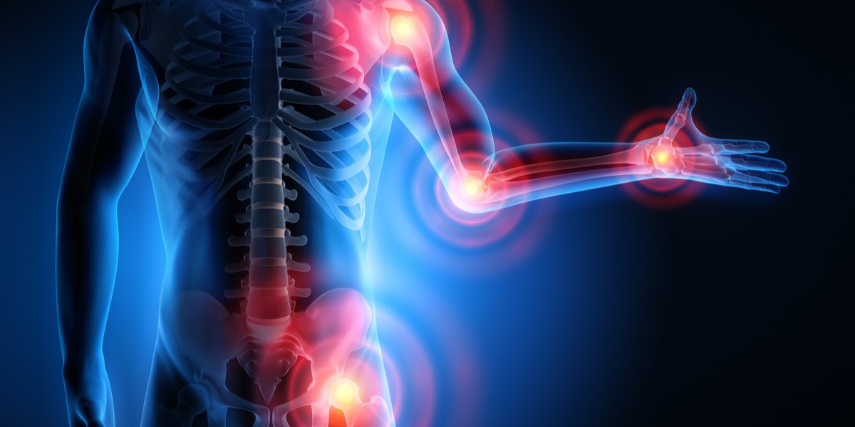 కీళ్లవాతం సమస్యతో బాధ పడుతున్నారా.. ఆ సమస్యకు చెక్ పెట్టే అద్భుతమైన చిట్కాలు ఇవే!