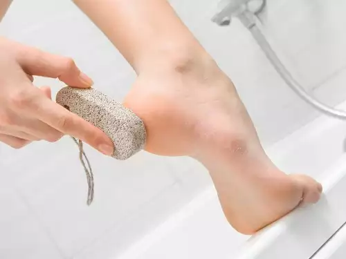 పాదాల పగుళ్ల వల్ల ఇబ్బందులు పడుతున్నారా.. చెక్ పెట్టే అద్భుతమైన చిట్కాలు ఇవే!