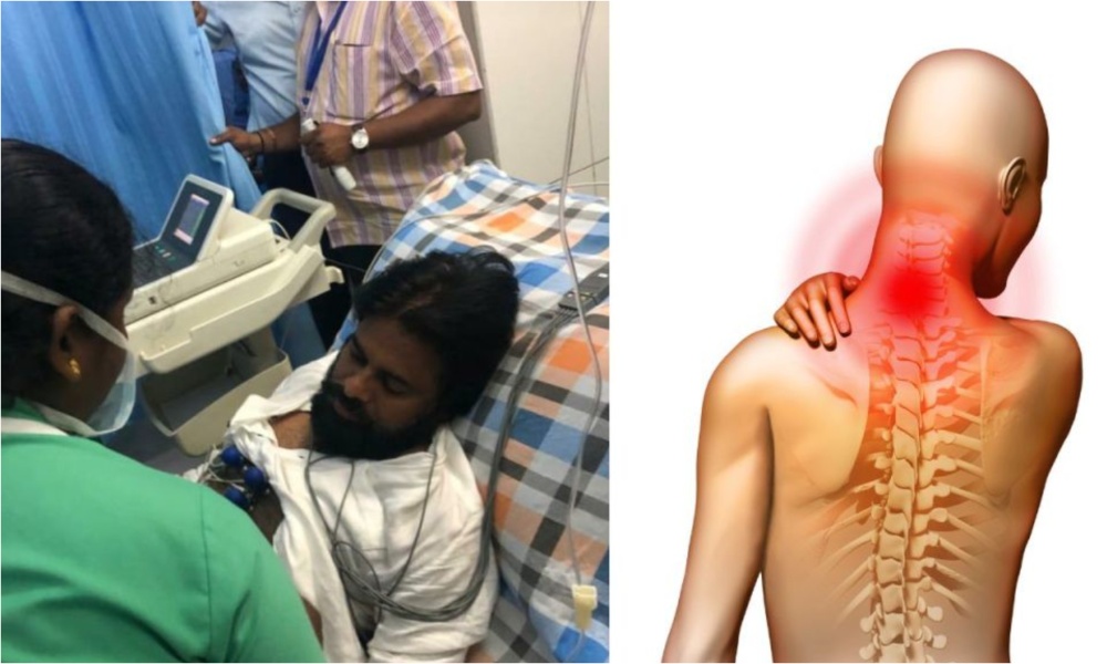 Pawan Kalyan: అరుదైన వ్యాధికి గురైన డిప్యూటీ సీఎం పవన్ కళ్యాణ్… వ్యాధి ముదిరితే పక్షవాతమే?