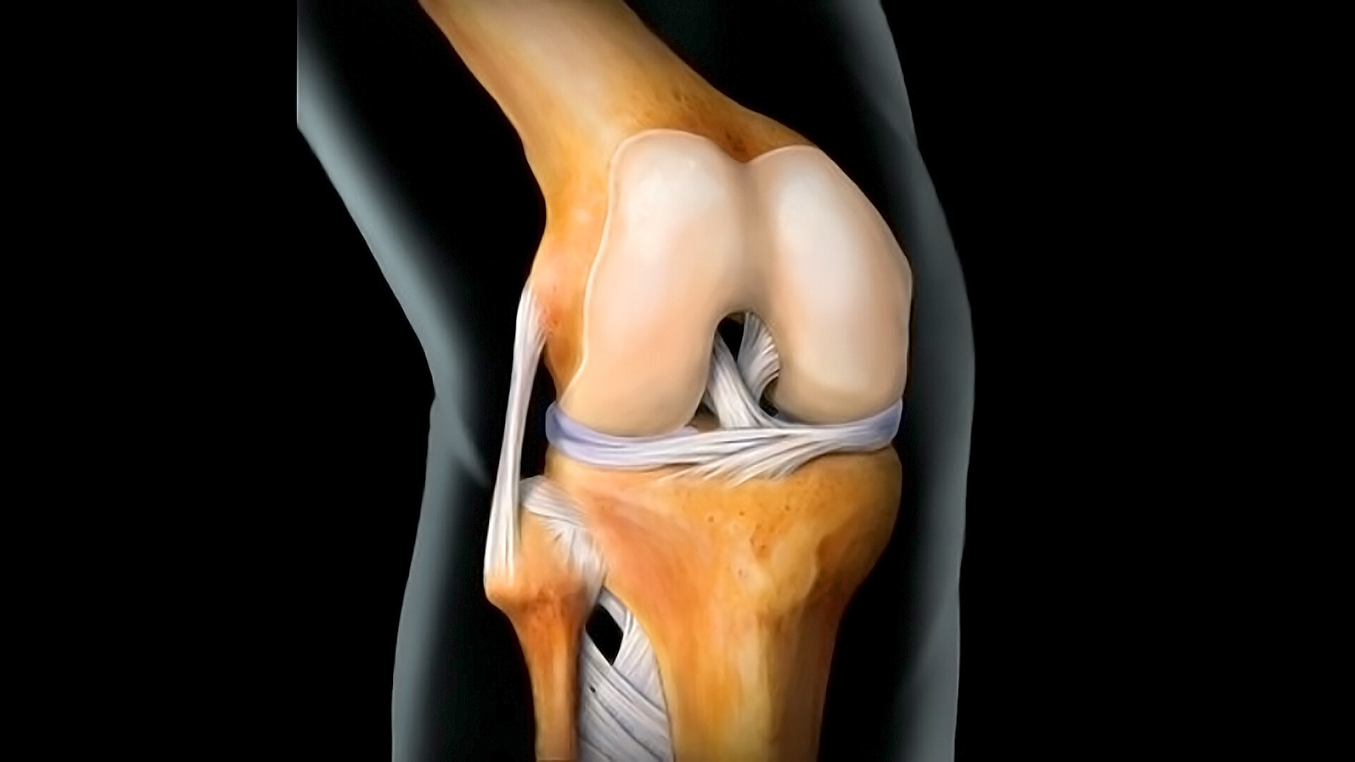 ఈ ఆహారాలు తింటే మాత్రం కీళ్ల నొప్పులు వచ్చే ఛాన్స్.. జాగ్రత్త పడాల్సిందే!