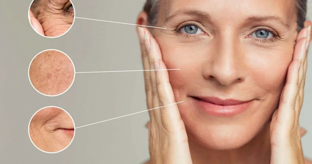 చర్మంపై ముడతల సమస్యతో ఇబ్బంది పడుతున్నారా.. ఈ చిట్కాలతో సమస్యకు చెక్!