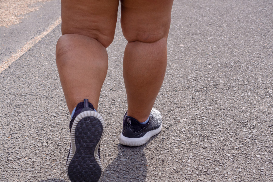 తరచుగా కాళ్లు లాగుతున్నాయా.. ఈ చిట్కాలు పాటిస్తే ఆ సమస్యకు చెక్ పెట్టవచ్చట!