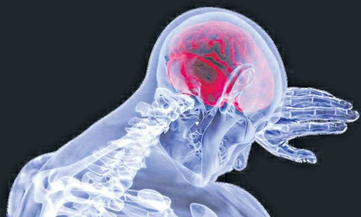 Brain Swelling: ఈ లక్షణాలు కనిపిస్తే మీకు మెదడు వాపు ఉన్నట్లే.. నిర్లక్ష్యం చేస్తే లైఫ్ ఫసక్..!