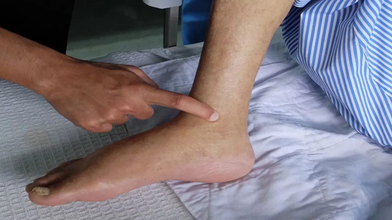 అరికాలి మంటల వల్ల బాధ, ఇబ్బంది పడుతున్నారా.. ఈ చిట్కాలు పాటిస్తే సేఫ్!