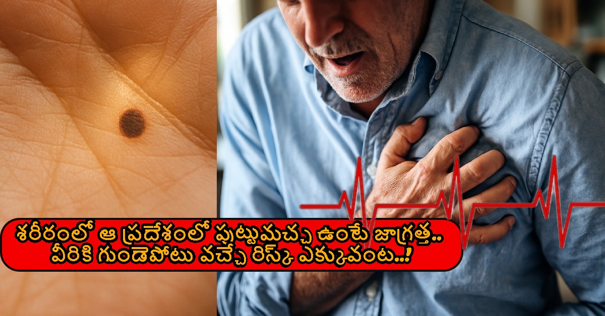 శరీరంలో ఆ ప్రదేశంలో పుట్టుమచ్చ ఉంటే జాగ్రత్త.. వీరికి గుండెపోటు వచ్చే రిస్క్ ఎక్కువంట..!